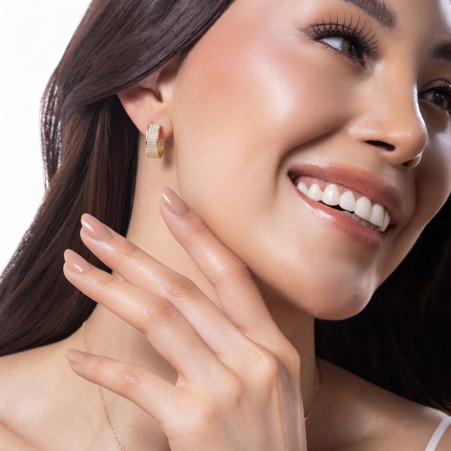 Aretes